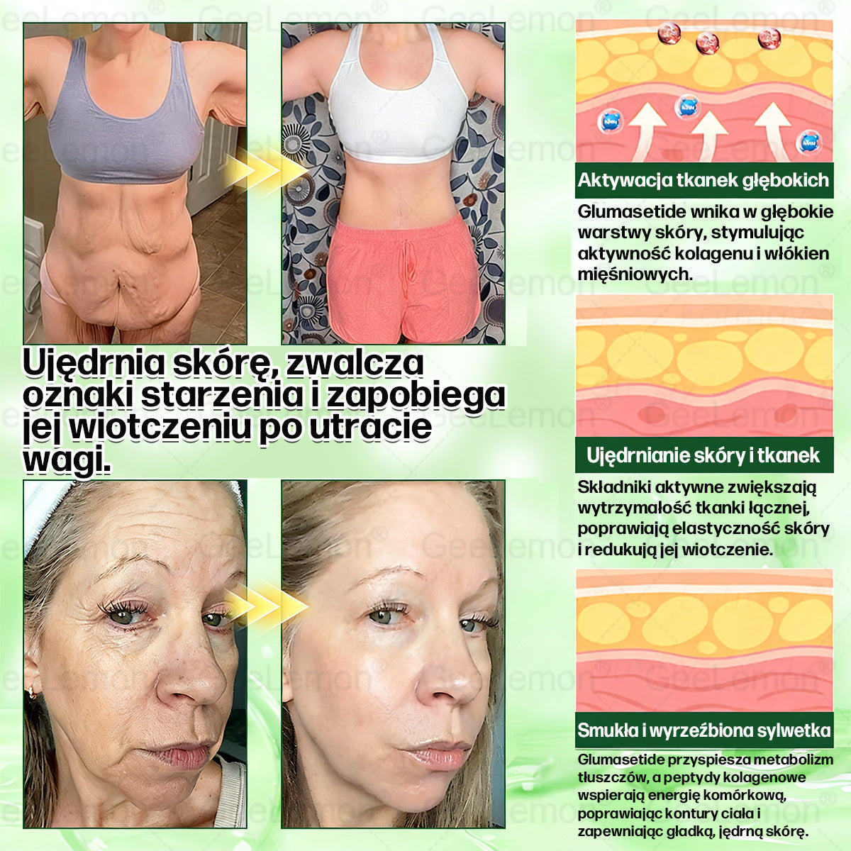 Oficjalny Sklep | 👩‍⚕️🩹 𝐆𝐞𝑒𝐿𝑒𝐦𝐨𝐧® 𝐆𝐥𝐮𝐦ase𝐭𝐢𝐝𝐞 10 𝐰 𝟏 Smukły i Zdrowy Nano Plaster z Mikronakłuciami 🇵🇱(Tylko raz dziennie, widoczne zmiany już w 7 dni)✅ Na otyłość, 🅛🅞🅞🅢🅔 🅢🅚🅘🅝 wiotką skórę, cukrzycę, bezdech senny, problemy ze stawami i wiele więcej