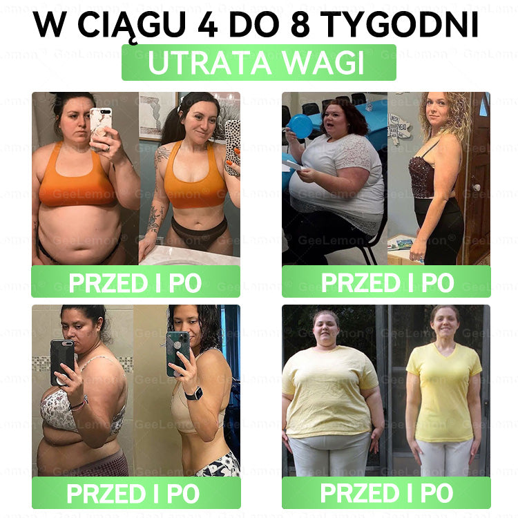 Oficjalny Sklep | 👩‍⚕️🩹 𝐆𝐞𝑒𝐿𝑒𝐦𝐨𝐧® 𝐆𝐥𝐮𝐦ase𝐭𝐢𝐝𝐞 10 𝐰 𝟏 Smukły i Zdrowy Nano Plaster z Mikronakłuciami 🇵🇱(Tylko raz dziennie, widoczne zmiany już w 7 dni)✅ Na otyłość, 🅛🅞🅞🅢🅔 🅢🅚🅘🅝 wiotką skórę, cukrzycę, bezdech senny, problemy ze stawami i wiele więcej