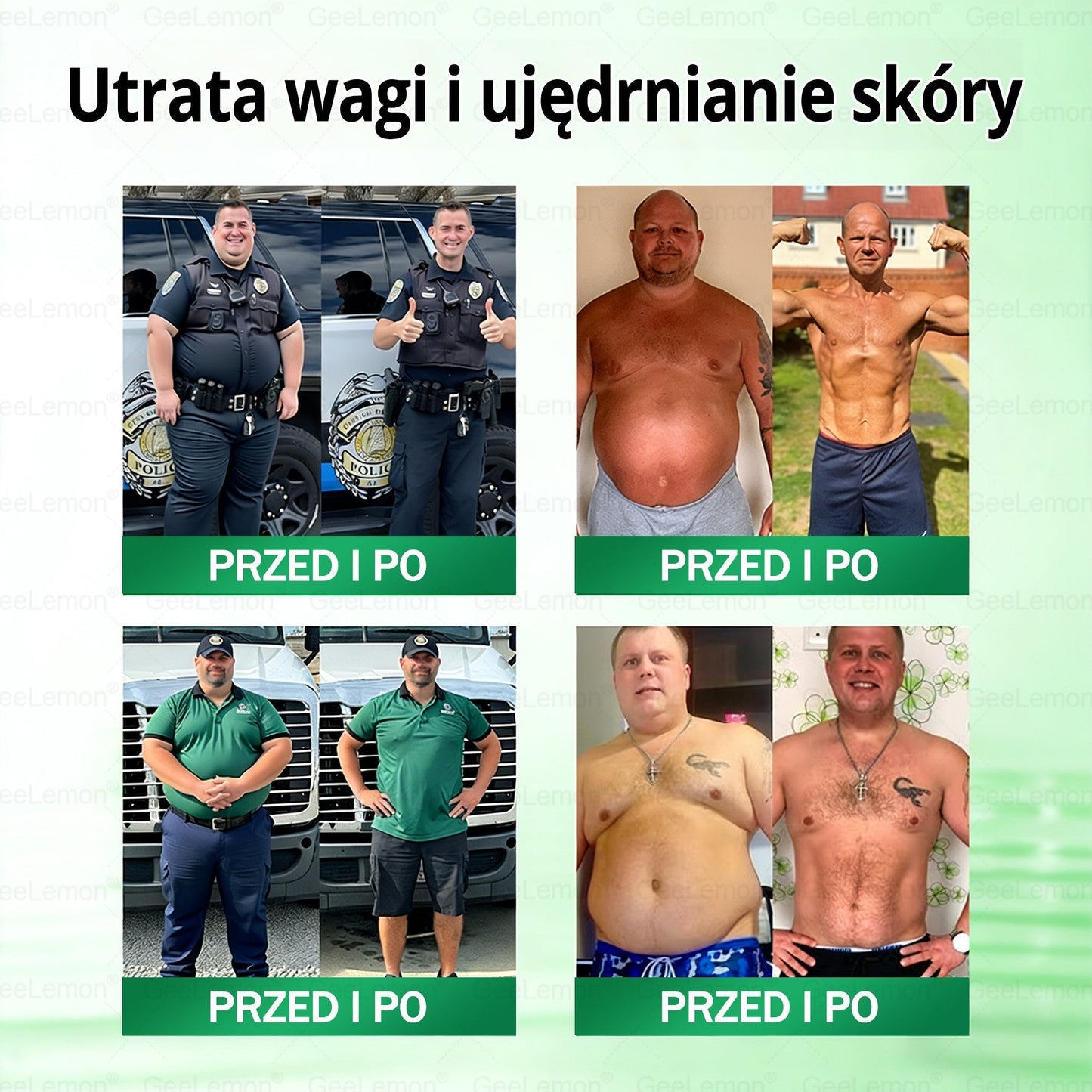 Oficjalny Sklep | 👩‍⚕️🩹 𝐆𝐞𝑒𝐿𝑒𝐦𝐨𝐧® 𝐆𝐥𝐮𝐦ase𝐭𝐢𝐝𝐞 10 𝐰 𝟏 Smukły i Zdrowy Nano Plaster z Mikronakłuciami 🇵🇱(Tylko raz dziennie, widoczne zmiany już w 7 dni)✅ Na otyłość, 🅛🅞🅞🅢🅔 🅢🅚🅘🅝 wiotką skórę, cukrzycę, bezdech senny, problemy ze stawami i wiele więcej