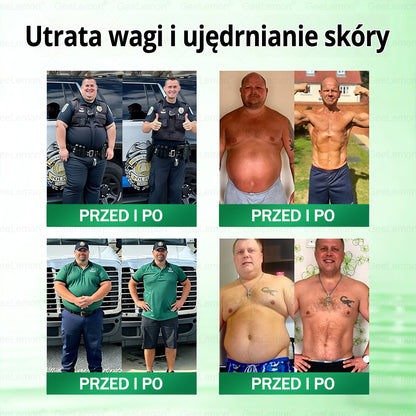 Oficjalny Sklep | 👩‍⚕️🩹 𝐆𝐞𝑒𝐿𝑒𝐦𝐨𝐧® 𝐆𝐥𝐮𝐦ase𝐭𝐢𝐝𝐞 10 𝐰 𝟏 Smukły i Zdrowy Nano Plaster z Mikronakłuciami 🇵🇱(Tylko raz dziennie, widoczne zmiany już w 7 dni)✅ Na otyłość, 🅛🅞🅞🅢🅔 🅢🅚🅘🅝 wiotką skórę, cukrzycę, bezdech senny, problemy ze stawami i wiele więcej