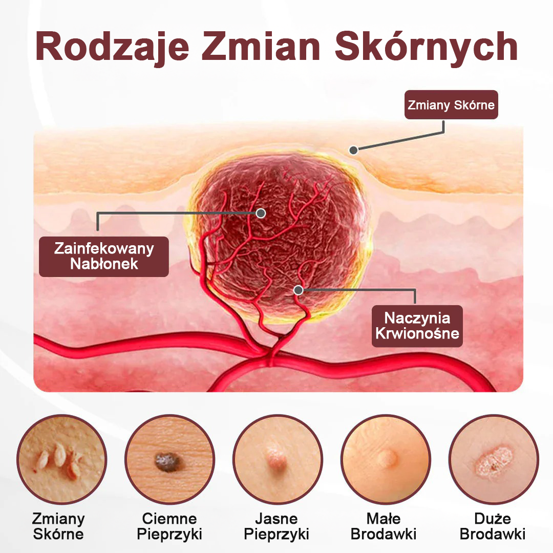 Krem regenerujący Biancat® KeraErase o podwójnym działaniu