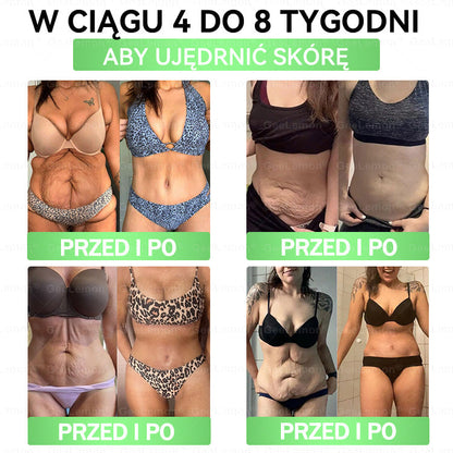 Oficjalny Sklep | 👩‍⚕️🩹 𝐆𝐞𝑒𝐿𝑒𝐦𝐨𝐧® 𝐆𝐥𝐮𝐦ase𝐭𝐢𝐝𝐞 10 𝐰 𝟏 Smukły i Zdrowy Nano Plaster z Mikronakłuciami 🇵🇱(Tylko raz dziennie, widoczne zmiany już w 7 dni)✅ Na otyłość, 🅛🅞🅞🅢🅔 🅢🅚🅘🅝 wiotką skórę, cukrzycę, bezdech senny, problemy ze stawami i wiele więcej