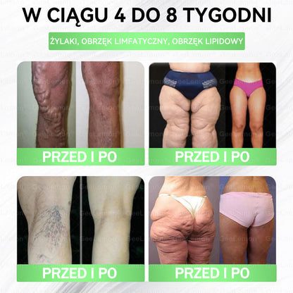 Oficjalny Sklep | 👩‍⚕️🩹 𝐆𝐞𝑒𝐿𝑒𝐦𝐨𝐧® 𝐆𝐥𝐮𝐦ase𝐭𝐢𝐝𝐞 10 𝐰 𝟏 Smukły i Zdrowy Nano Plaster z Mikronakłuciami 🇵🇱(Tylko raz dziennie, widoczne zmiany już w 7 dni)✅ Na otyłość, 🅛🅞🅞🅢🅔 🅢🅚🅘🅝 wiotką skórę, cukrzycę, bezdech senny, problemy ze stawami i wiele więcej