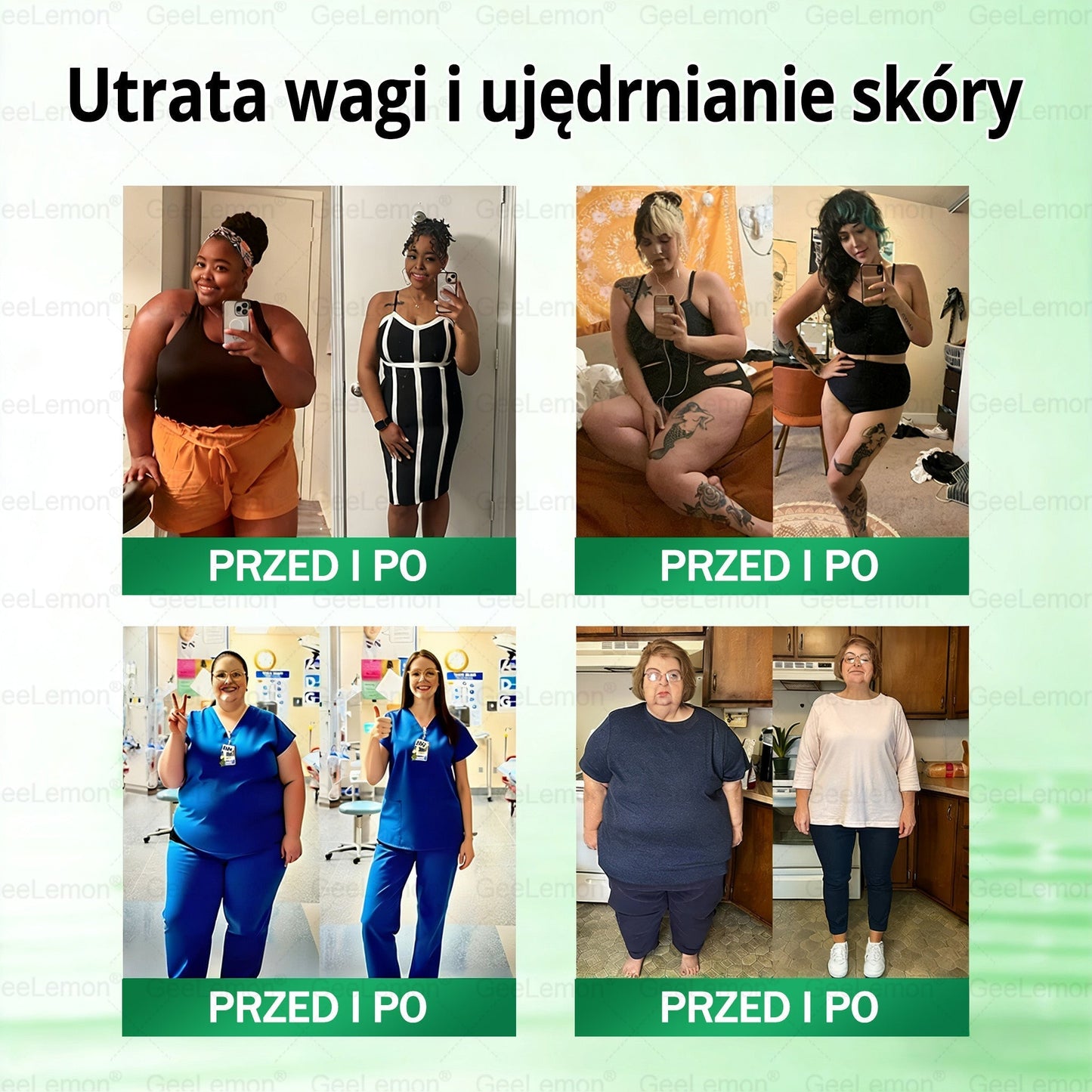 Oficjalny Sklep | 👩‍⚕️🩹 𝐆𝐞𝑒𝐿𝑒𝐦𝐨𝐧® 𝐆𝐥𝐮𝐦ase𝐭𝐢𝐝𝐞 10 𝐰 𝟏 Smukły i Zdrowy Nano Plaster z Mikronakłuciami 🇵🇱(Tylko raz dziennie, widoczne zmiany już w 7 dni)✅ Na otyłość, 🅛🅞🅞🅢🅔 🅢🅚🅘🅝 wiotką skórę, cukrzycę, bezdech senny, problemy ze stawami i wiele więcej