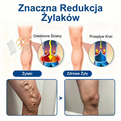 👨‍⚕️🔥Płatki pielęgnacyjne z mikronakłuwaniem GFOUK® VeinEase⚡Natychmiastowa ulga, długotrwałe rezultaty
