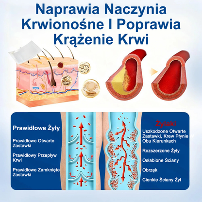 👨‍⚕️🔥Płatki pielęgnacyjne z mikronakłuwaniem GFOUK® VeinEase⚡Natychmiastowa ulga, długotrwałe rezultaty