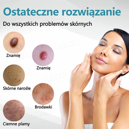 Cvreoz® nowy nieinwazyjny laser do usuwania pieprzyków i brodawek 🎉🎉🎉